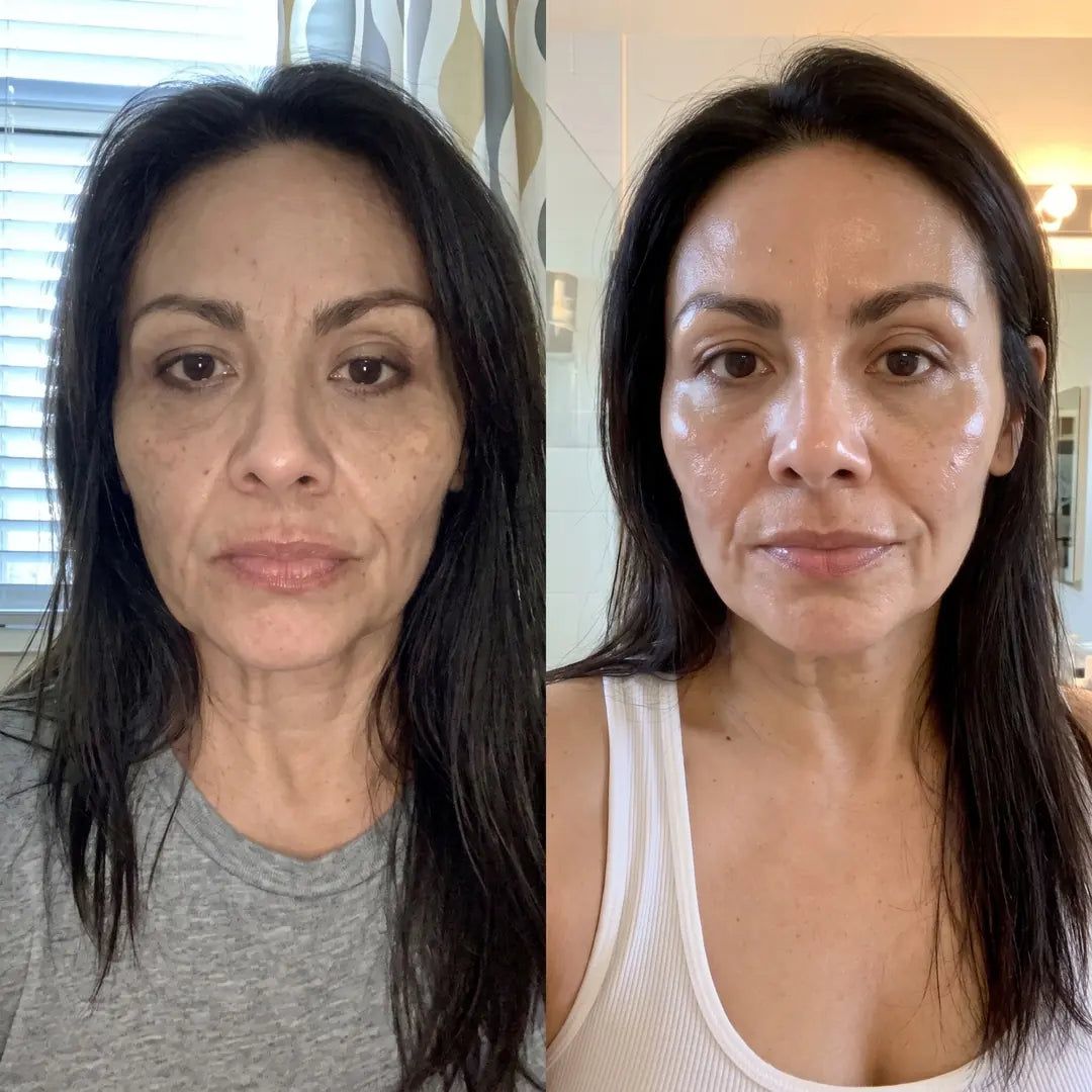Mascarilla De Colágeno - Tu Rostro Firme y Descansado. Sin Agujas.