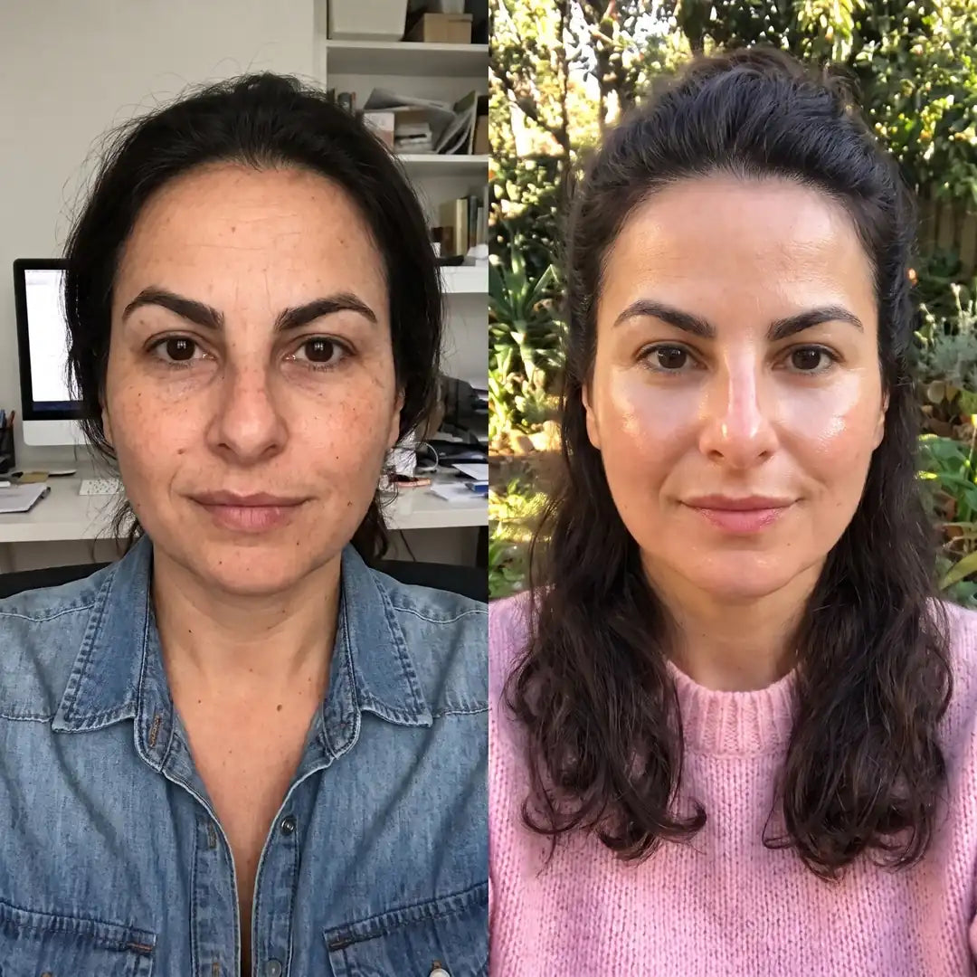 Mascarilla De Colágeno - Tu Rostro Firme y Descansado. Sin Agujas.
