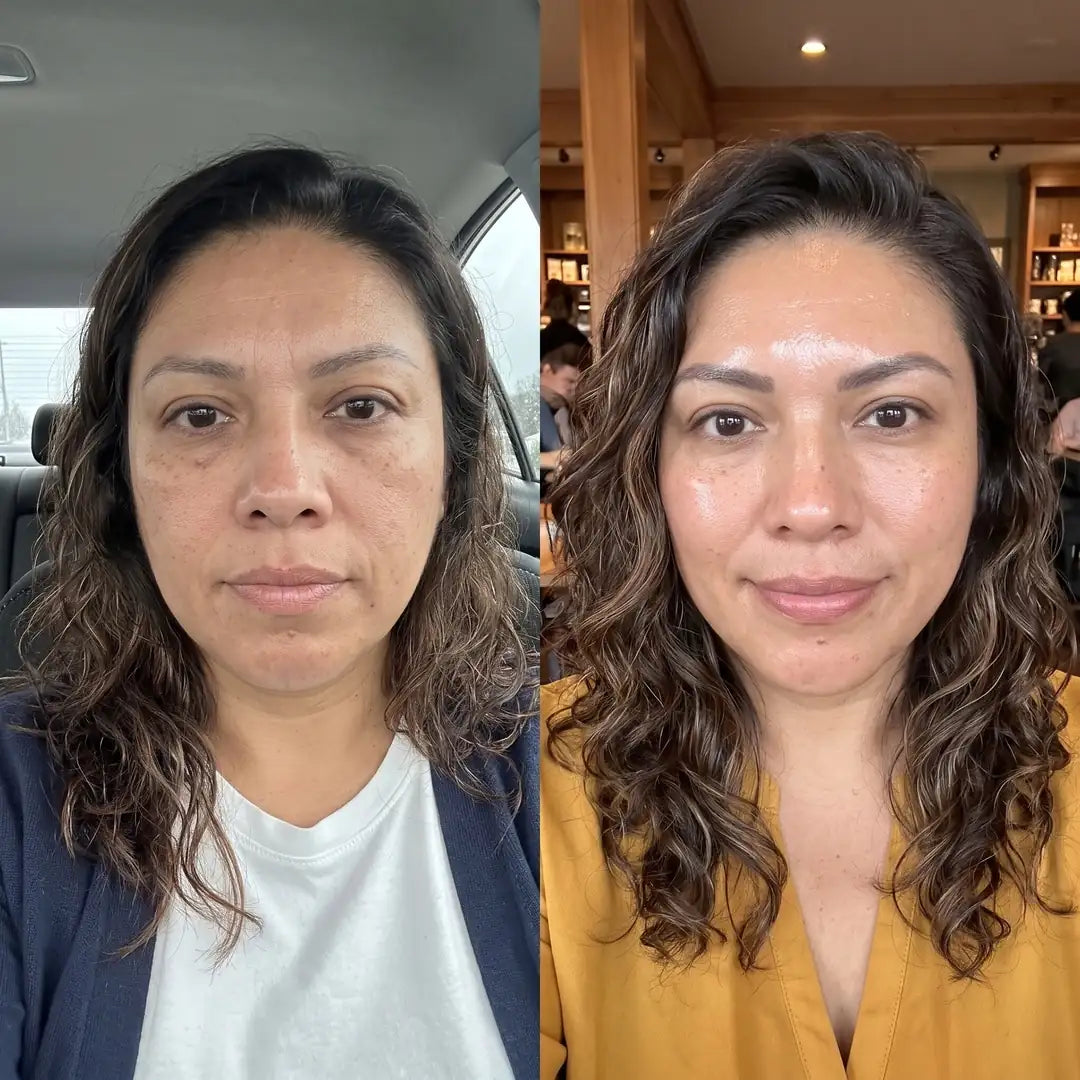 Mascarilla De Colágeno - Tu Rostro Firme y Descansado. Sin Agujas.