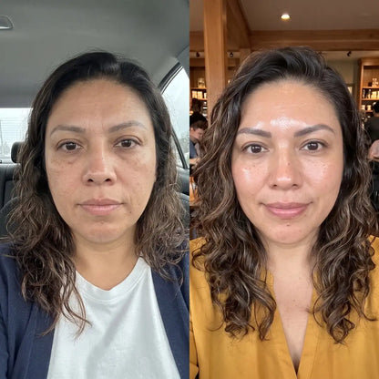 Mascarilla De Colágeno - Tu Rostro Firme y Descansado. Sin Agujas.