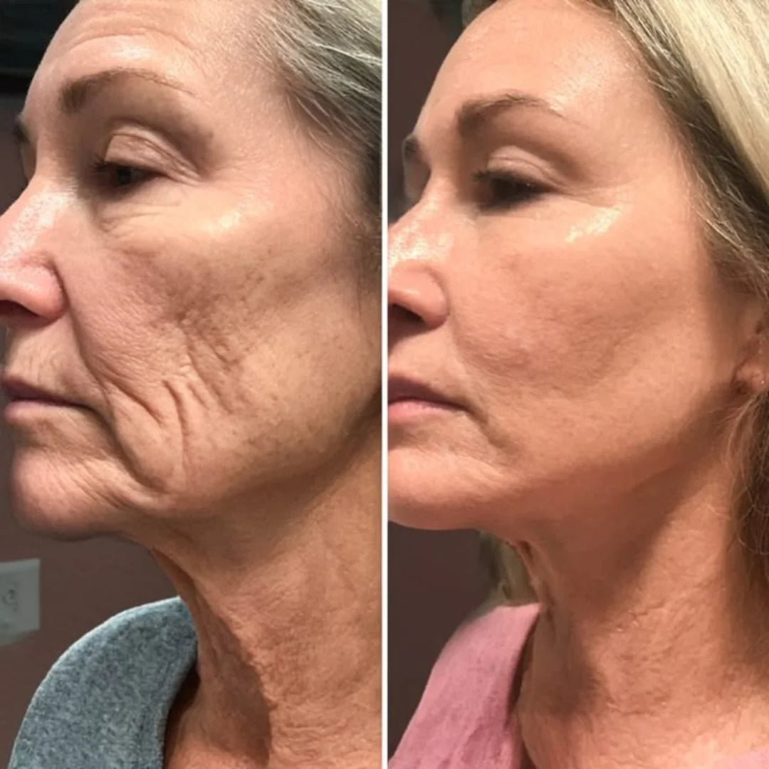 SkinPro - Reafirma la piel flácida del rostro en solo 5 minutos al día