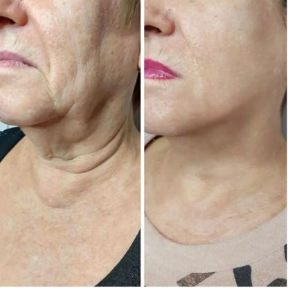 SkinPro - Reafirma la piel flácida del rostro en solo 5 minutos al día