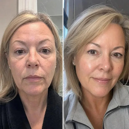 Mascarilla De Colágeno - Rejuvenece Tu Piel Mientras Te Relajas (5 Mascarillas Por Caja)