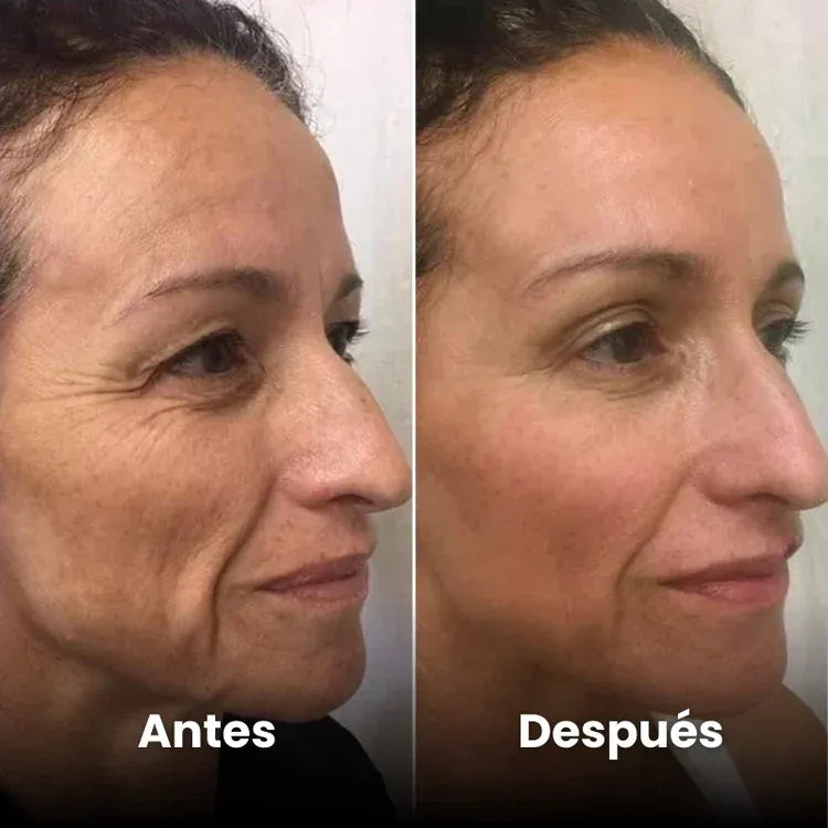 Ana