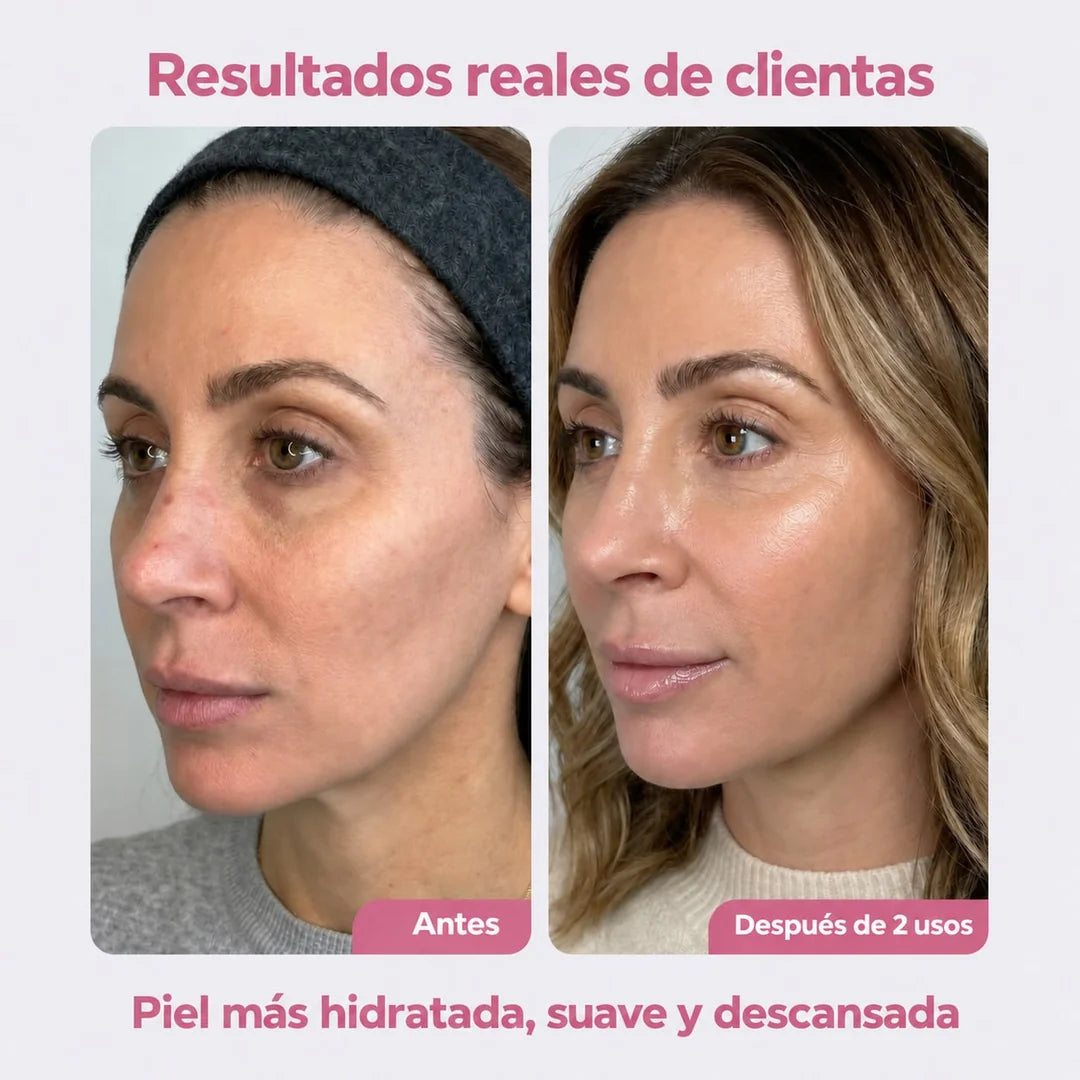 Mascarilla De Colágeno - Tu Rostro Firme y Descansado. Sin Agujas.